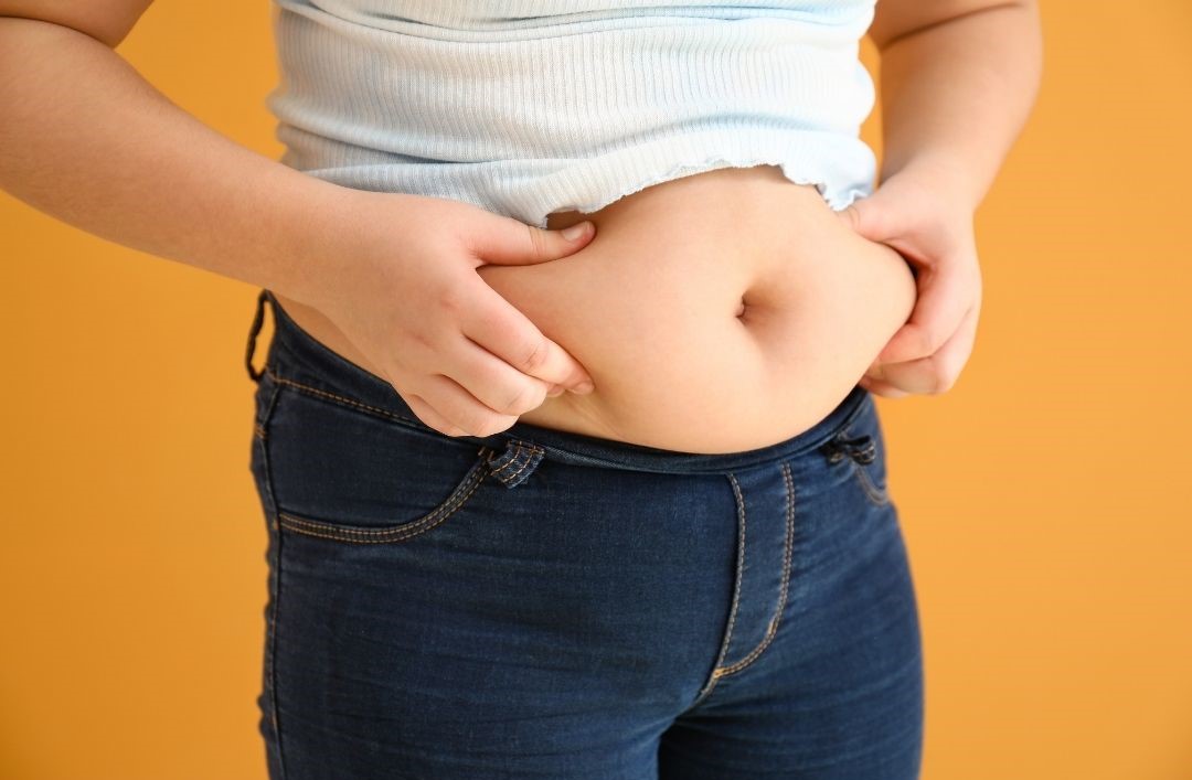 Hormonbauch dargestellt von adipöser Frau mit hängendem Bauch über der Hose